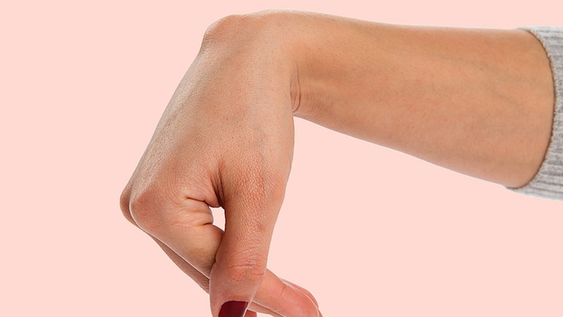 Bướu hoạt dịch cổ tay là gì? Nguyên nhân, chẩn đoán và cách điều trị 2