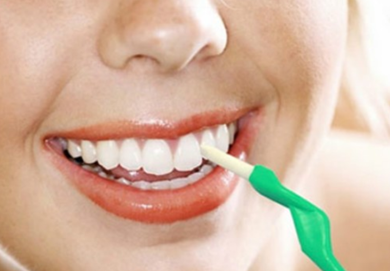 Gel&nbsp;làm trắng răng thường chứa các thành phần hoạt tính hydrogen peroxide hoặc carbamide peroxide