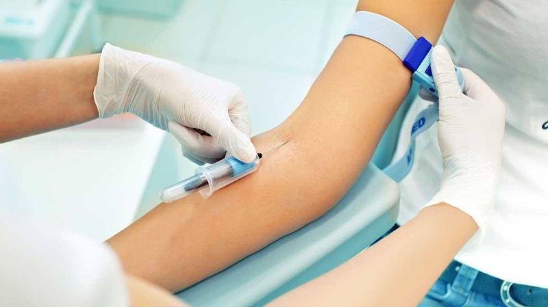 C peptide là gì? Ý nghĩa kết quả của xét nghiệm C peptide 3