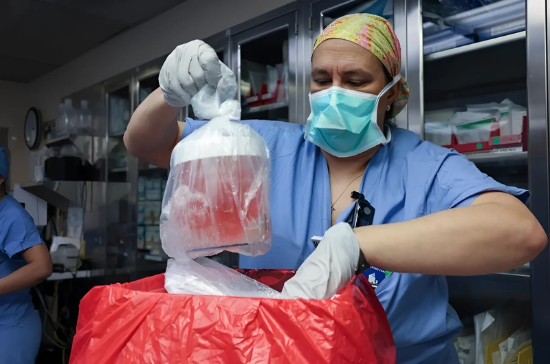 Ca ghép thận lợn được chỉnh sửa gen cho người đầu tiên trên thế giới 3