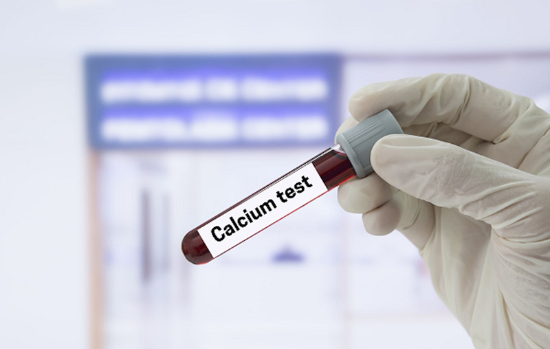 ca-la-gi-y-nghia-cac-chi-so-xet-nghiem-sinh-hoa-mau 3