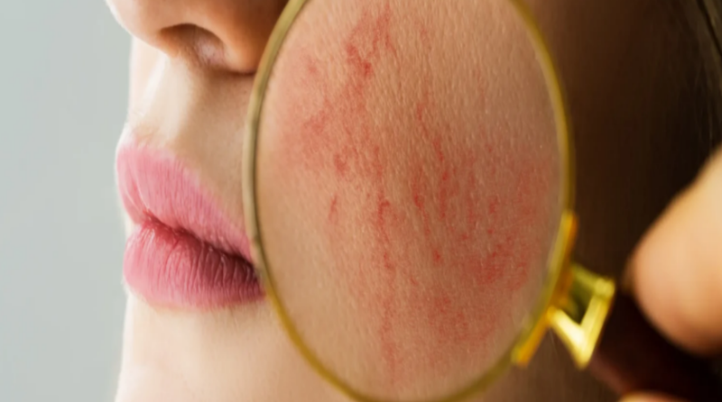 Cá mao ếch: Loài cá bổ dưỡng và tốt cho sức khỏe 4