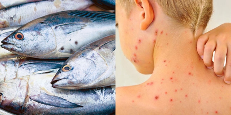 Cá ngừ bao nhiêu calo? Những lưu ý khi ăn cá ngừ 4