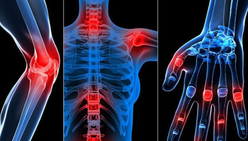 Các bài thuốc dân gian chữa bệnh viêm đa khớp hiệu quả nhất 1