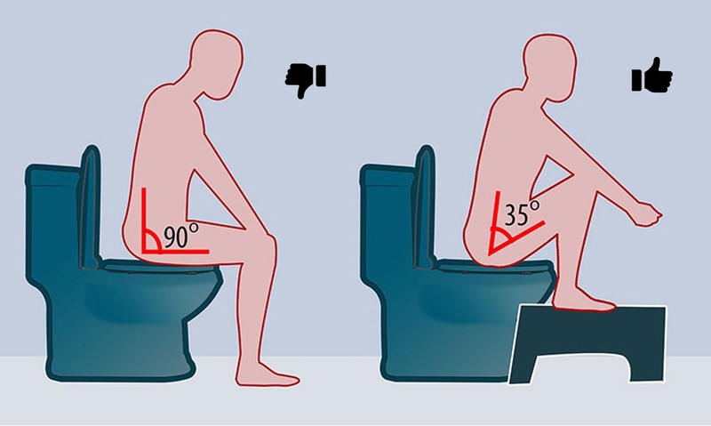 Các bệnh về đại tràng phổ biến hiện nay 3