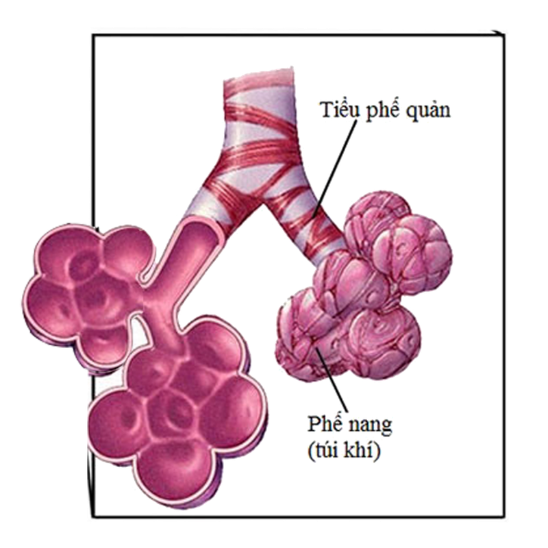 Các bệnh lý liên quan đến tiểu phế quản-1