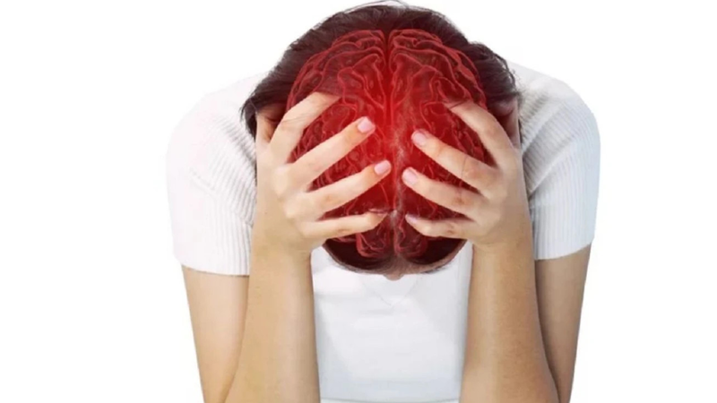 Các bệnh lý mạch máu não thường gặp 4