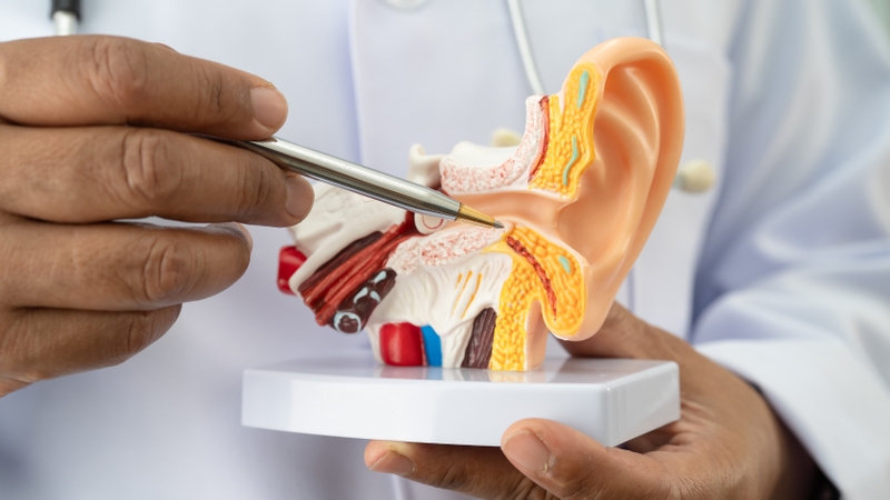 Bệnh Meniere là rối loạn tai trong liên quan đến sự thay đổi áp lực nội dịch mê đạo