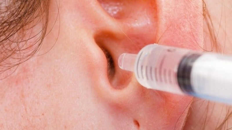 Vệ sinh tai đúng cách là biện pháp hữu hiệu giúp phòng ngừa các loại viêm tai