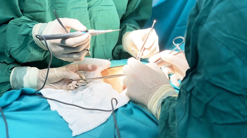 Các biện pháp tránh thai cho nam giới hiệu quả, an toàn 2