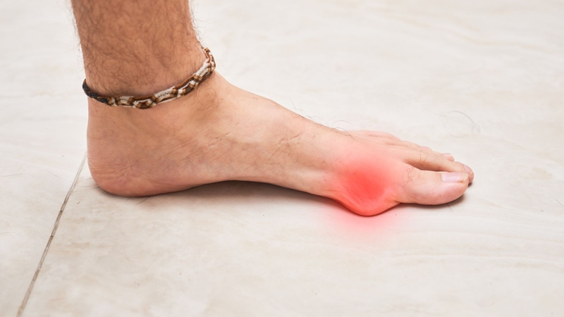 Khi khối u phát triển lớn và nằm gần bề mặt da, người bệnh có thể quan sát thấy vùng xương bị biến dạng hoặc sưng phồng rõ rệt