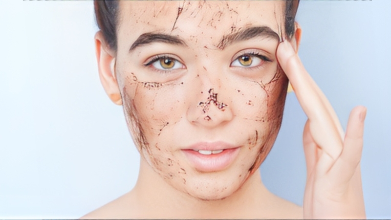 Các bước skincare da mụn đúng chuẩn bạn cần biết