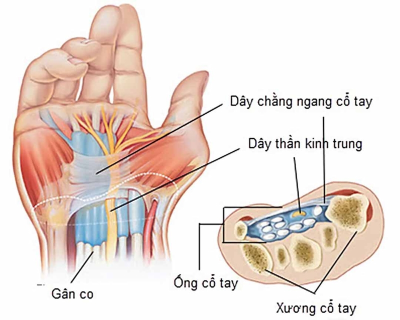 Hướng dẫn sơ cứu dập ngón tay đúng cách 1