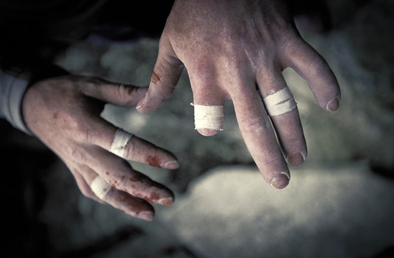 Hướng dẫn sơ cứu dập ngón tay đúng cách 3