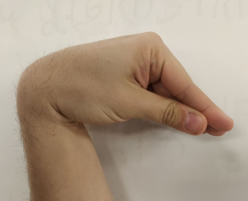 Các bước sơ cứu hạ canxi máu 2