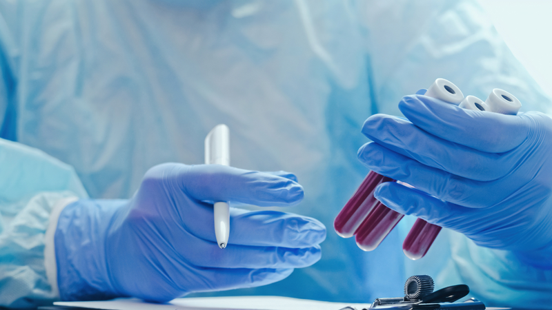 Kết quả xét nghiệm máu cung cấp thông tin quan trọng về mức độ lan rộng và đặc điểm khối u