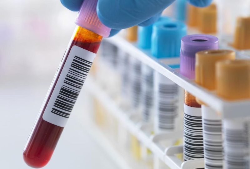 Xét nghiệm CMP là gì? Các yếu tố ảnh hưởng tới kết quả xét nghiệm 1