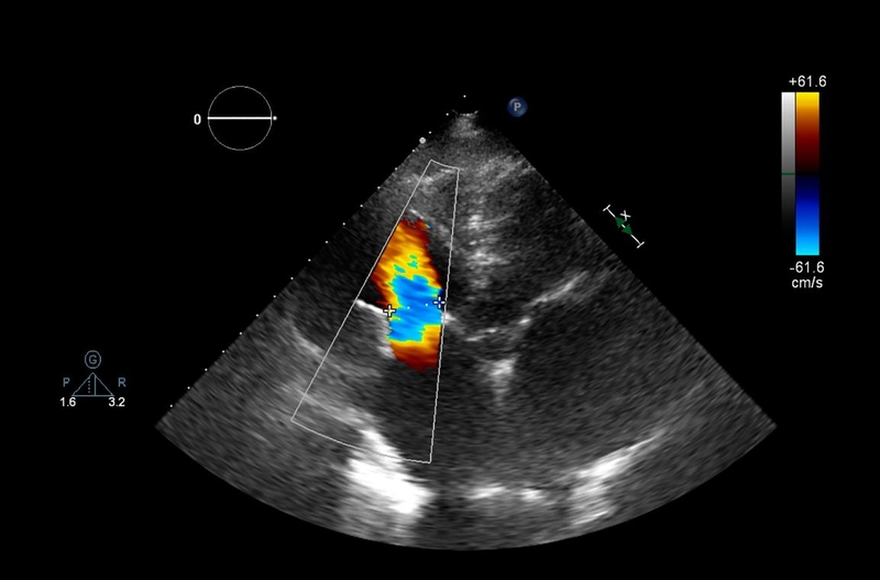 Tìm hiểu về các chỉ số đánh giá chức năng của tim 1