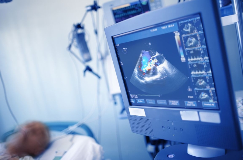 Tìm hiểu về các chỉ số đánh giá chức năng của tim 3