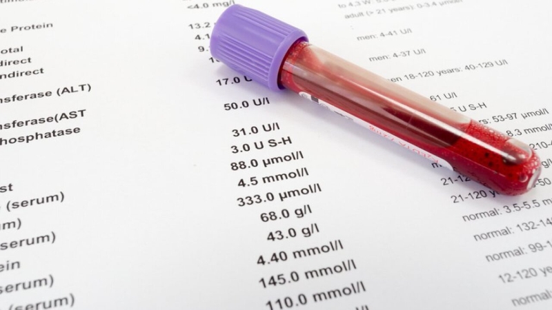 Các chỉ số trong xét nghiệm máu gồm những gì và có ý nghĩa như thế nào? 3