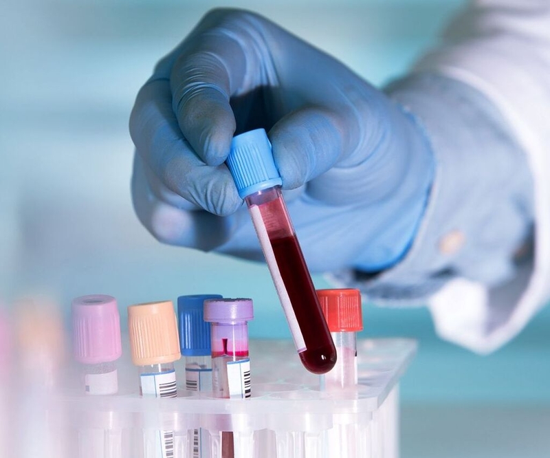 Các chỉ số xét nghiệm máu phát hiện ung thư phổ biến hiện nay không phải ai cũng biết 2