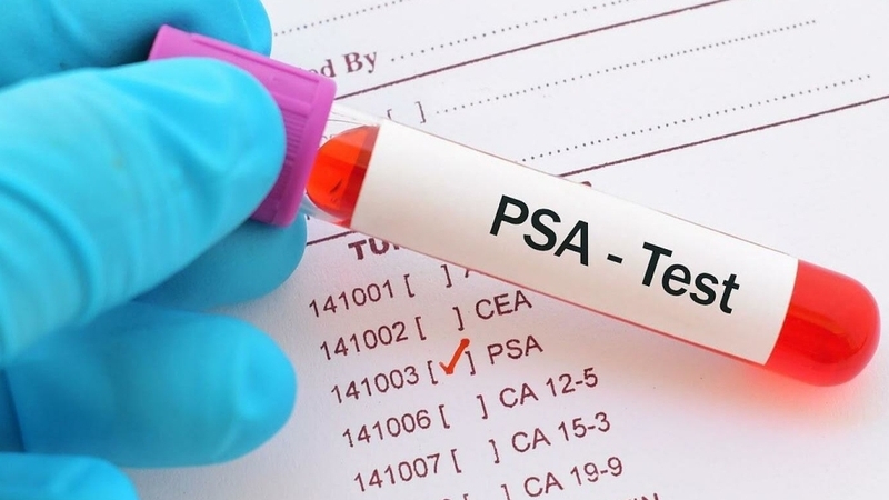 Các chỉ số xét nghiệm máu phát hiện ung thư phổ biến hiện nay không phải ai cũng biết 4