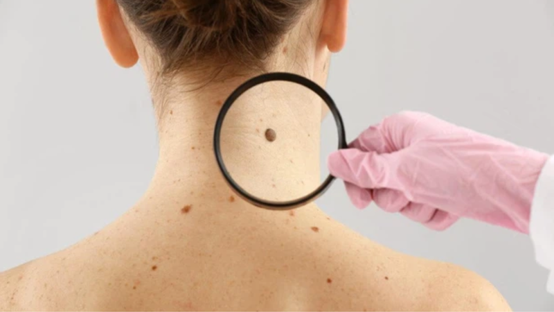 Các dấu hiệu ung thư cần chú ý 1