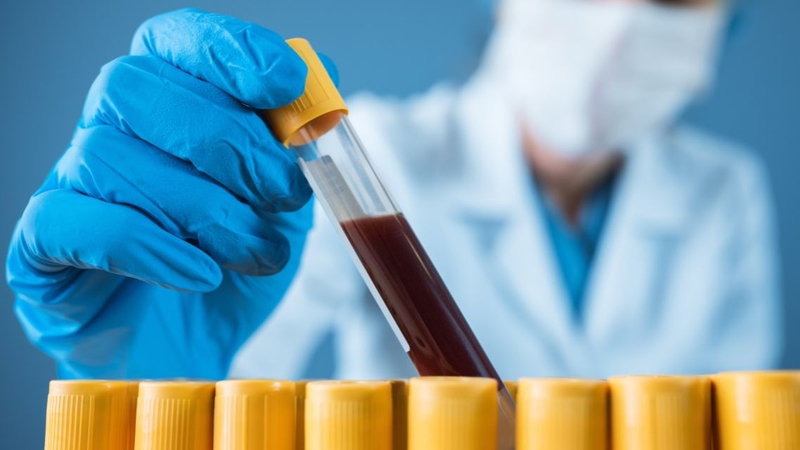 Tốt nhất nên xin tư vấn của bác sĩ để chọn loại xét nghiệm máu phù hợp
