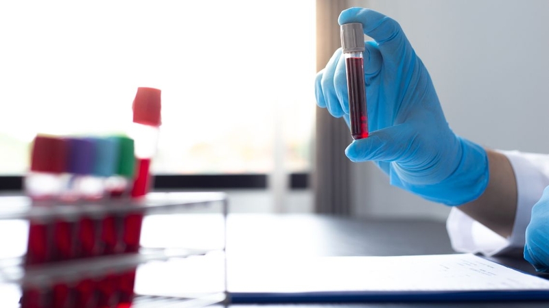 Kết quả xét nghiệm máu cần được đọc bởi bác sĩ