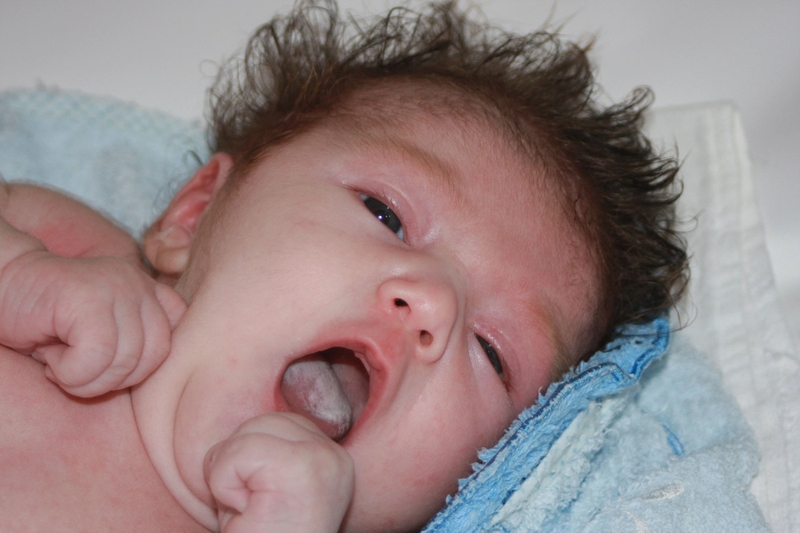 Các hình ảnh nấm lưỡi của bé mà bố mẹ cần nhận biết 1