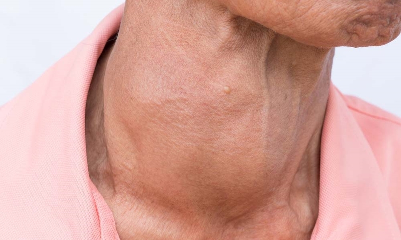 Các hormone tiết ra từ tuyến giáp và chức năng đối với cơ thể 3