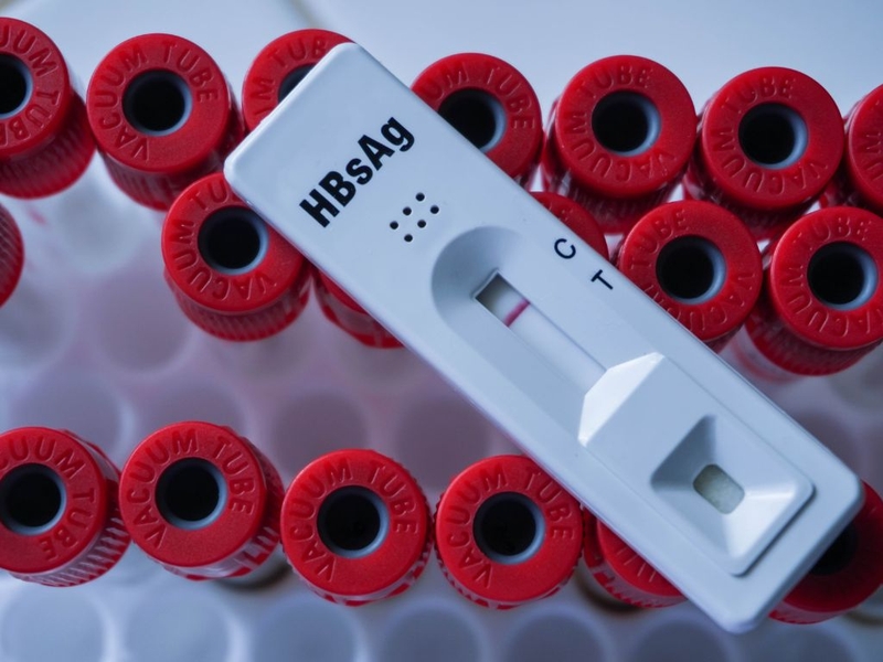 Các kháng nguyên virus viêm gan B và vai trò của chúng trong chẩn đoán bệnh 2