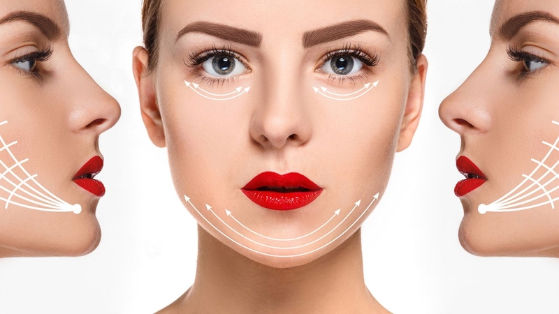 Căng cơ mặt bằng chỉ Ultra V Lift giúp loại bỏ các dấu hiệu lão hóa sớm trên da