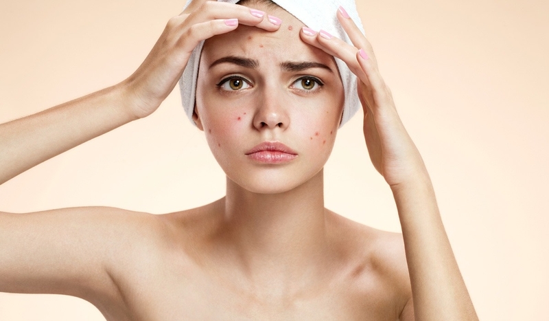 cac-loai-mun-trung-ca-thuong-gap-va-cach-phong-ngua-mun-trung-ca 3.jpg