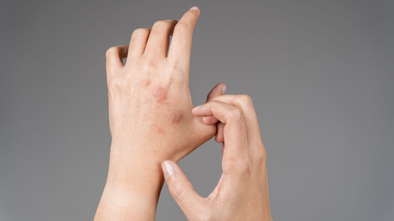 Hiểu rõ các loại ngứa da thường gặp là chìa khóa để kiểm soát triệu chứng