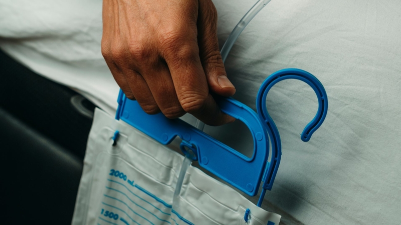 Việc đặt ống thông tiểu có thể gây cảm giác đau rát hoặc khó chịu nhẹ