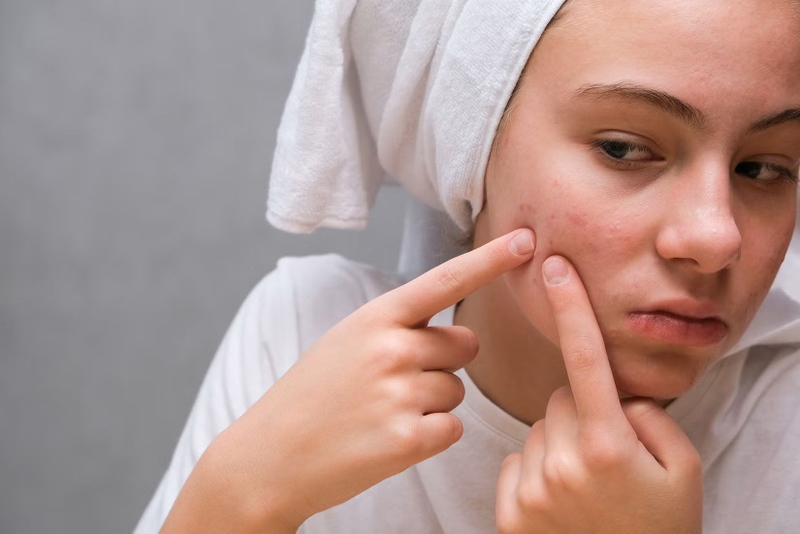 Ăn quá cay dễ dẫn đến nổi mụn, nóng trong,...