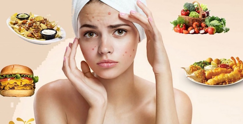 Việc ăn uống cũng ảnh hưởng rất lớn đến việc mọc mụn trứng cá