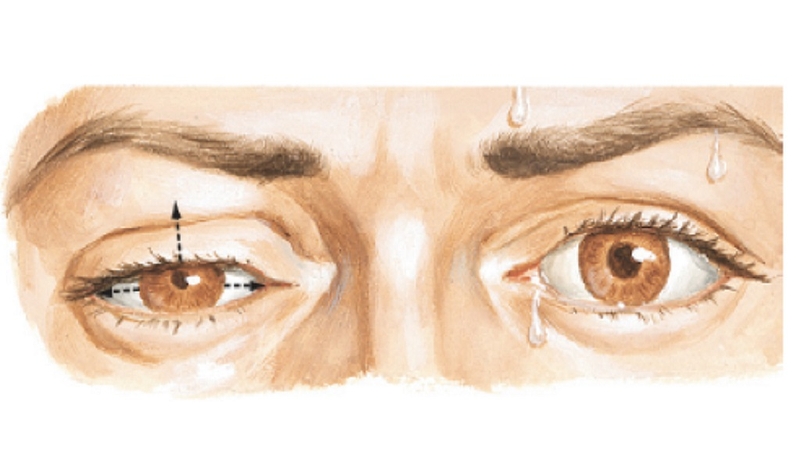 Các loại thuốc nam chữa bệnh nhược cơ hiệu quả được nhiều người tin dùng nhất 2