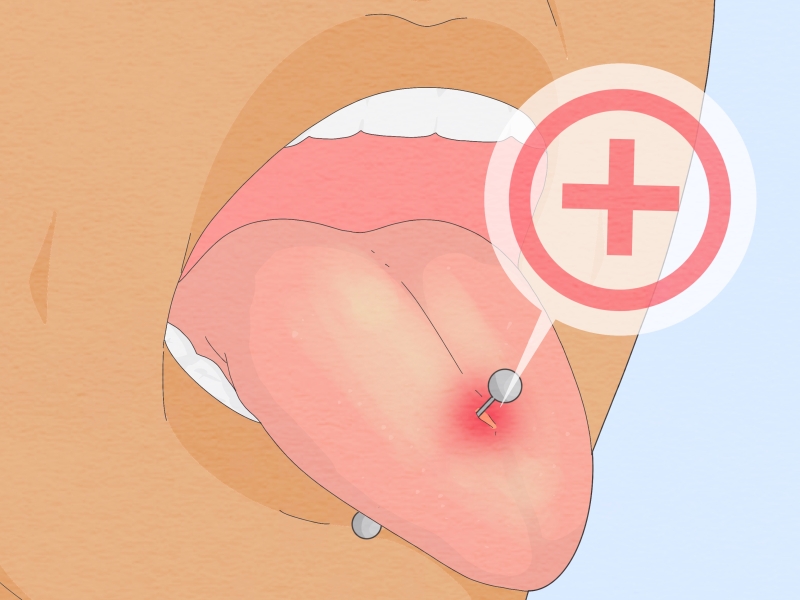 Các loại xỏ khuyên lưỡi? Xỏ khuyên lưỡi có tháo được không? 3