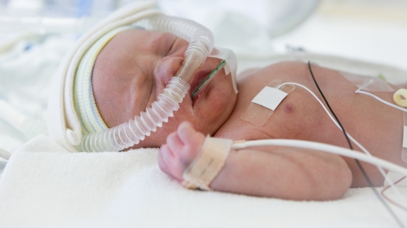 Các loại xuất huyết não: Phân loại cụ thể và cách chẩn đoán 3