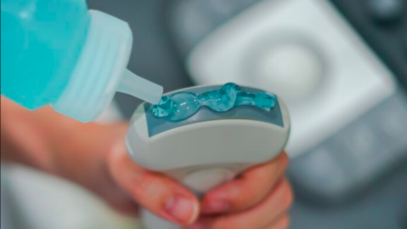 Các mặt cắt cơ bản trong siêu âm bụng 02