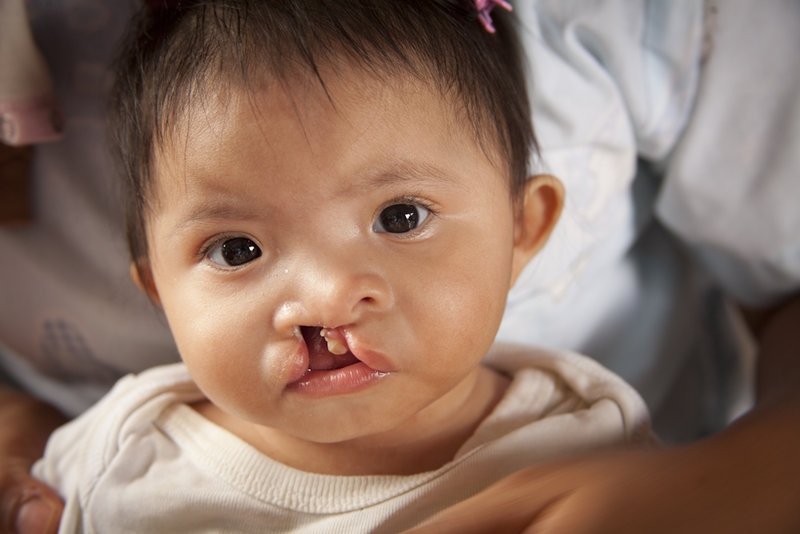 mốc khám thai quan trọng thứ 4