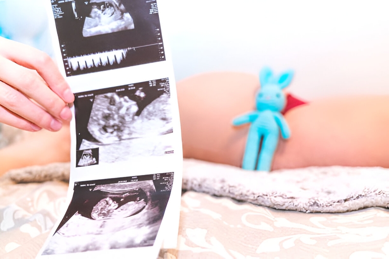 Các mốc siêu âm quan trọng trong thai kỳ mà mẹ bầu cần ghi nhớ-3