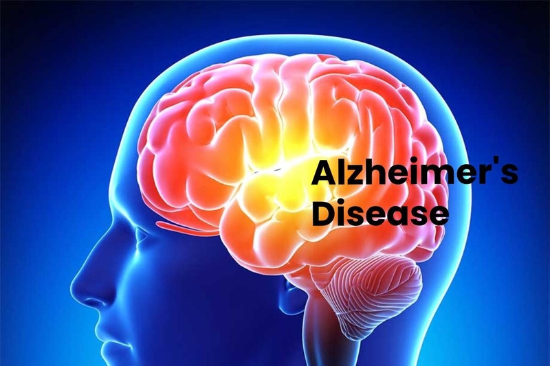 Các nhà khoa học khám phá ra cách virus herpes gây ra bệnh Alzheimer 1