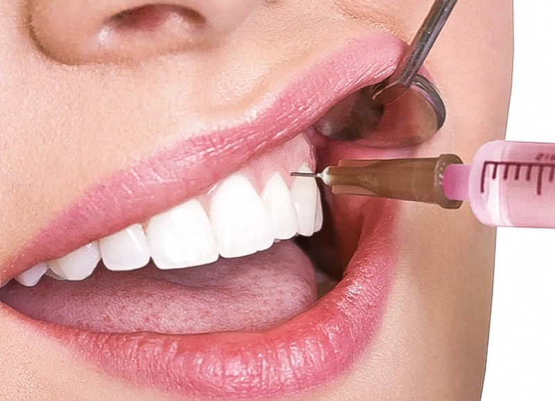 Các phương pháp gây tê thường dùng và một số vấn đề cần lưu ý về kỹ thuật gây tê 2