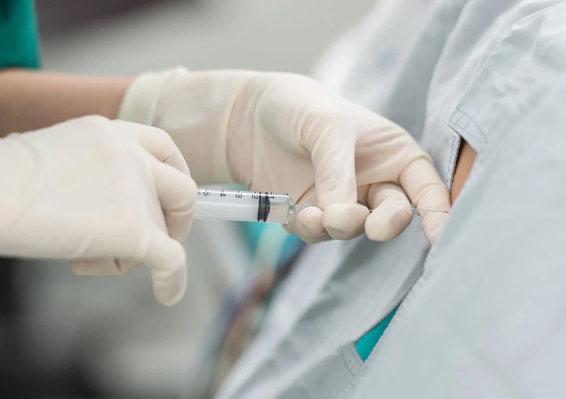 Các phương pháp gây tê thường dùng và một số vấn đề cần lưu ý về kỹ thuật gây tê 3