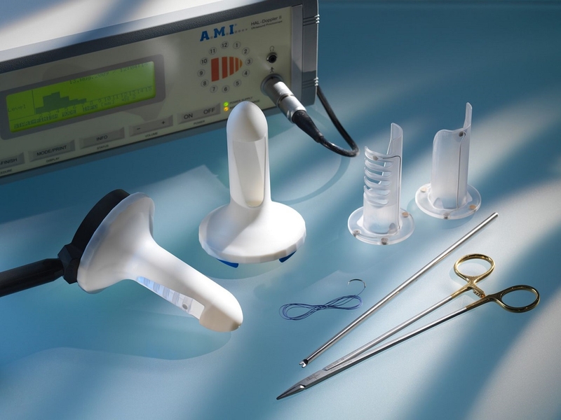 Các phương pháp phẫu thuật khâu triệt mạch trĩ 2