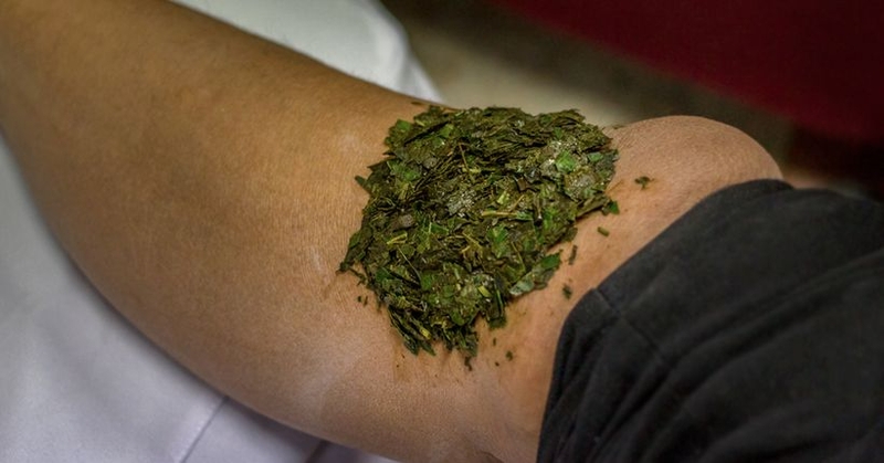 Các phương pháp sơ cứu khi bị rắn cắn 3