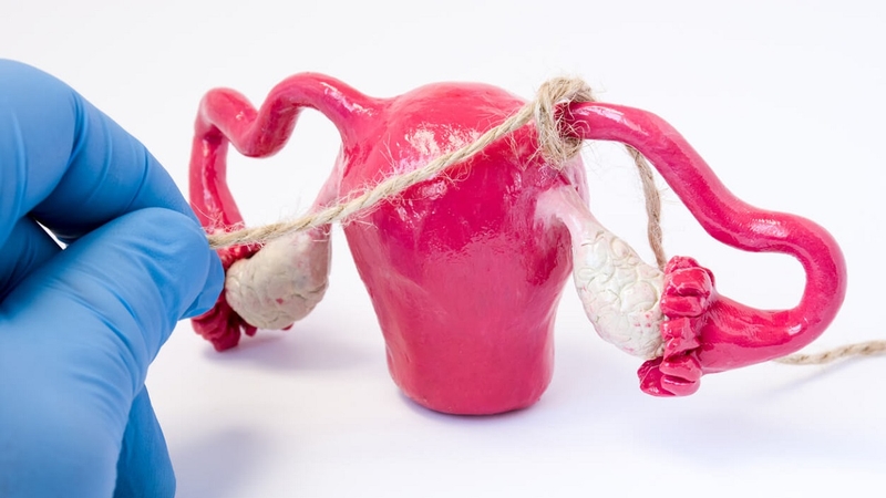 Các phương pháp triệt sản nữ và những câu hỏi thường gặp 1